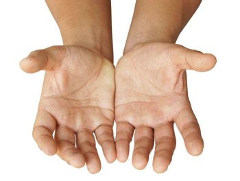 Sadə əyləncə ölümcül xəstəliyin qarşısını aldı