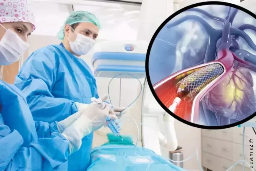 Mütəxəssislər “anjiyo epidemiyası”na qarşı xəbərdarlıq edirlər
