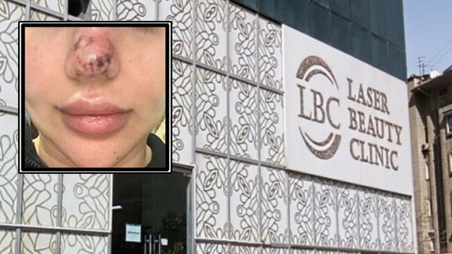Burun Dolğusu Faciəsi: Klinikanın Fəaliyyəti Dayandırıldı - FOTO