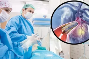 Mütəxəssislər “anjiyo epidemiyası”na qarşı xəbərdarlıq edirlər