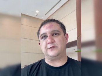 Moskva məhkəməsi ekstremist çağırışlara görə blogeri həbs etdi