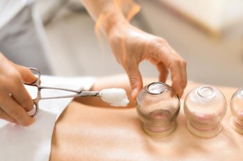 Vakuumla müalicə: Banka terapiyası qan dövranını necə yaxşılaşdırır?