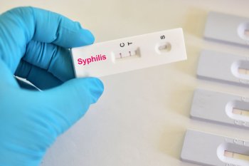 Slovakiyada sifilisə yoluxma halları rekord həddə çatdı