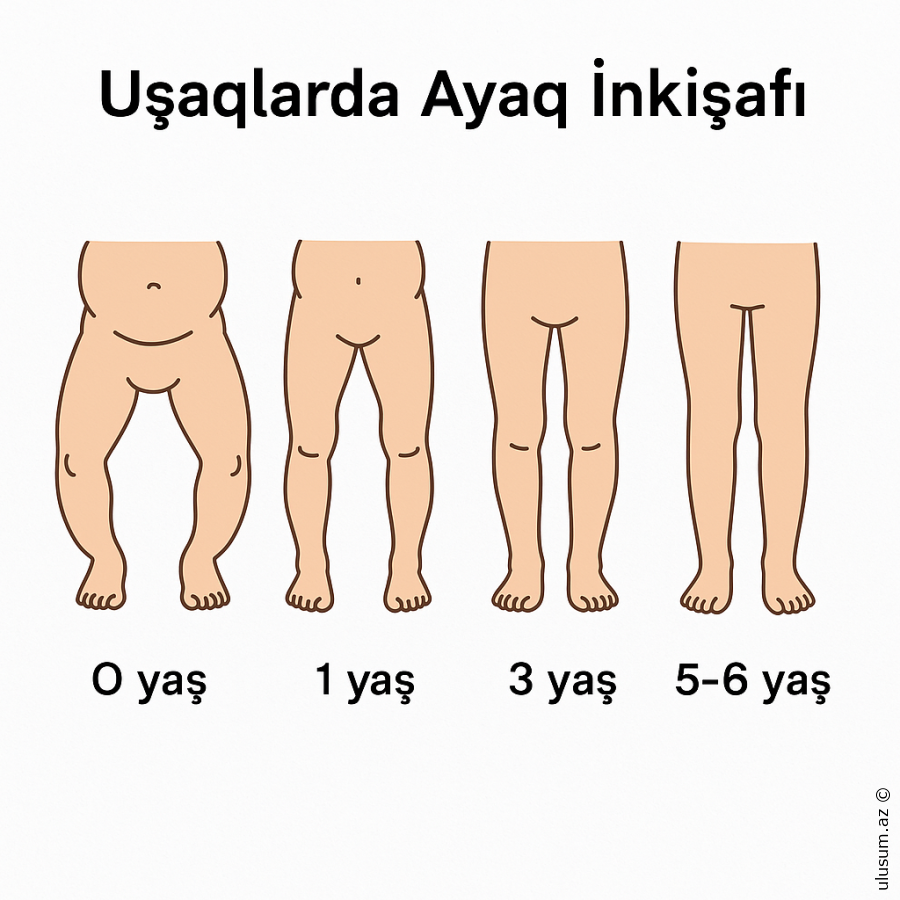 Uşaqlarda Ayaq İnkişafı və Deformasiya Arasındakı Əlaqə