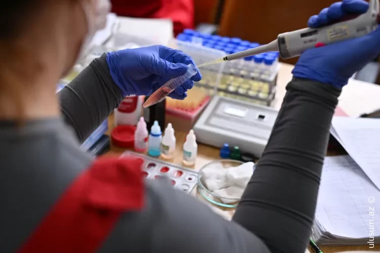 Hepatit C-ni 30 dəqiqəyə müəyyən edən ilk ekspress-test hazırlandı