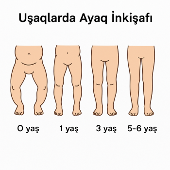 Uşaqlarda Ayaq İnkişafı və Deformasiya Arasındakı Əlaqə