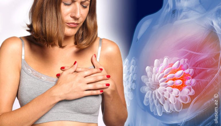 Süd vəziləri nə vaxtdan yoxlanmalıdır?